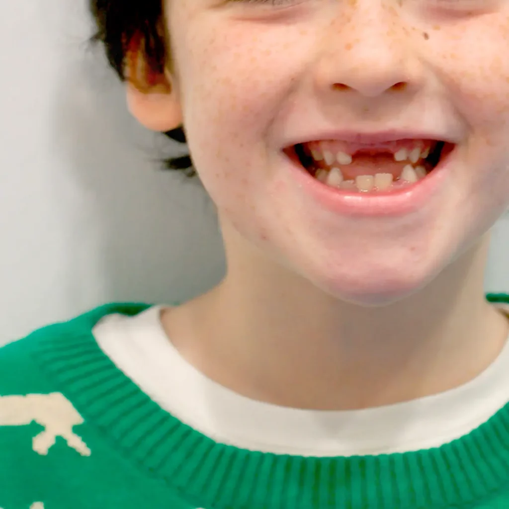 echeverria-del-valle-orthodontics-all-ages-children