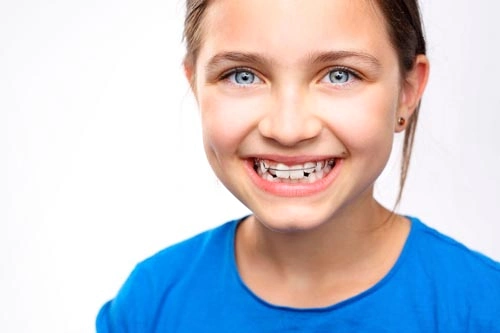 functional-orthodontics-for-children-treatments-san-sebastian